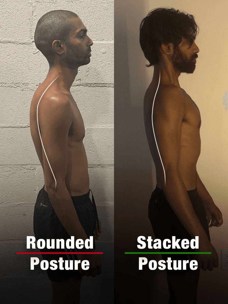 Brandon, 29: posture before and after the program