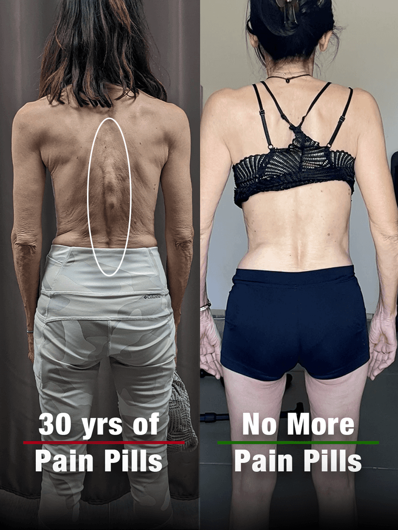 Christiane, 70: posture before and after the program