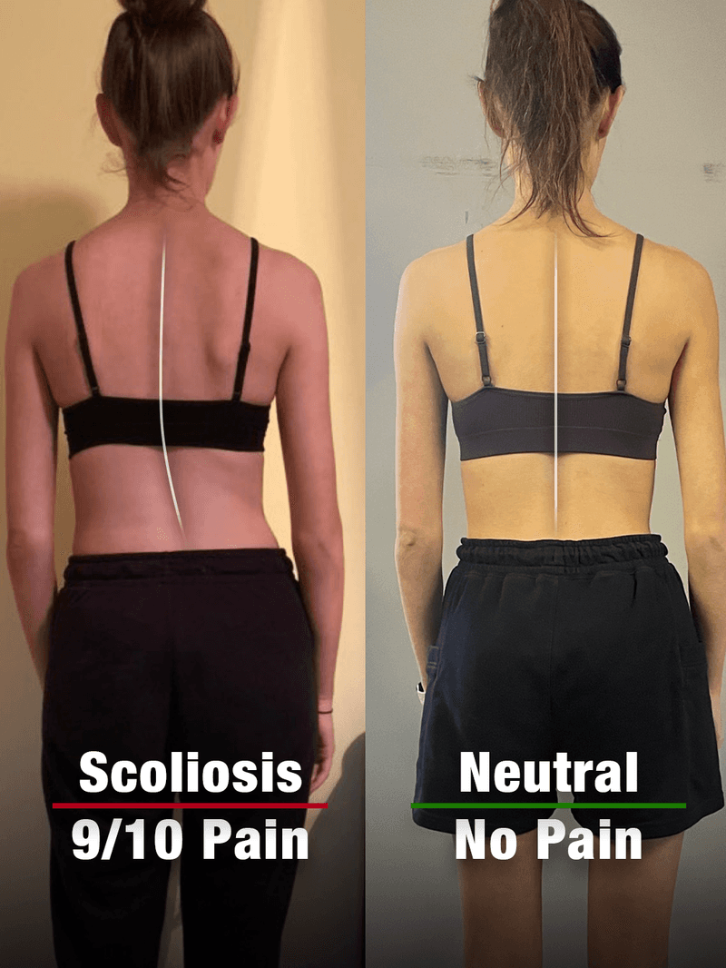 Emma, 22: posture before and after the program