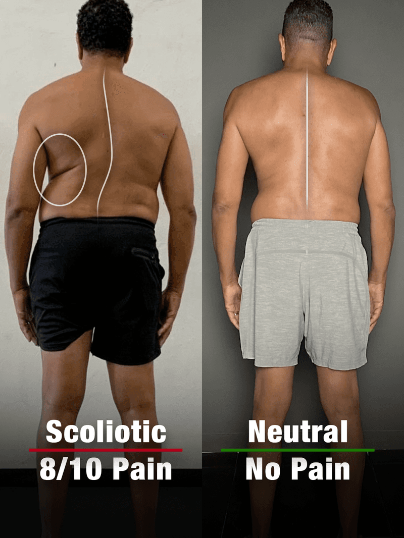 George, 64: posture before and after the program