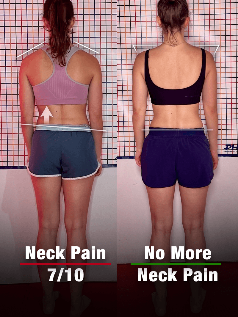 Sam, 26: posture before and after the program